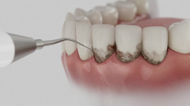 Trusted Teeth Cleaning And Checkup service in Monrovia, IN - Dentist Open Now